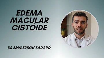 Como tratar edema macular Cistóide?