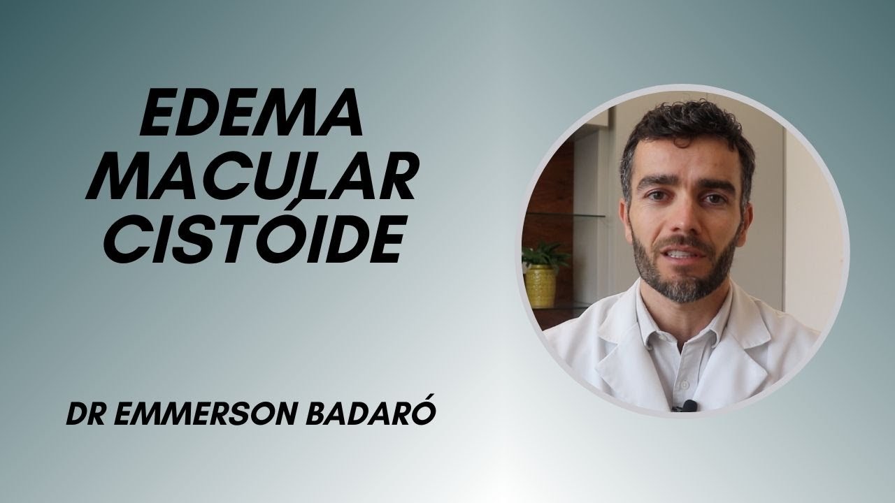 Edema Macular Cist Ide Dr Emmerson Badar Youtube