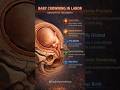 Baby Crowning in Labor: Final Stage of Childbirth Explained#Childbirth #LaborAndDelivery #Pregnancy