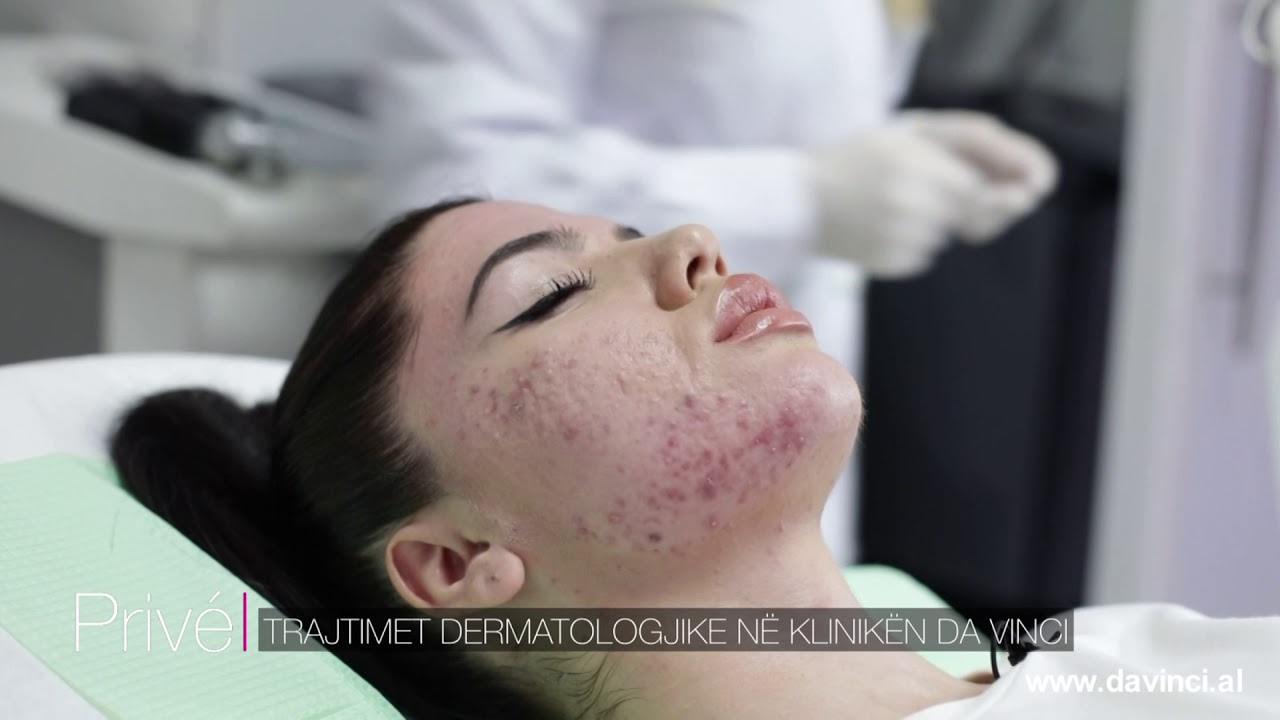 TRAJTIMET DERMATOLOGJIKE NE KLINIKEN DA VINCI