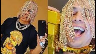 Famous RAPPER Gets GOLD CHAINS Surgically IMPLANTED Into His SCALP Wealth