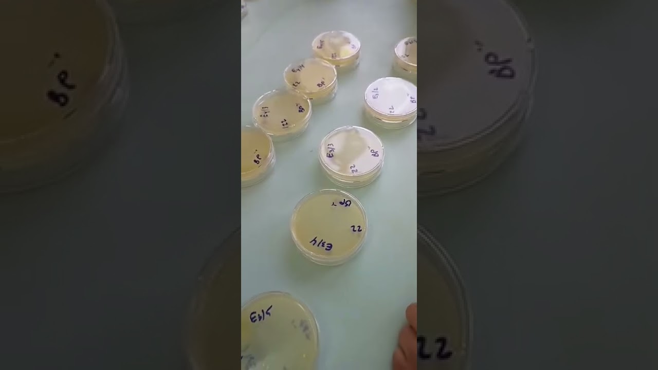 Jour 01:analyses physico-chimiques et microbiologiques des fromage fondu (un stage pratique complet)