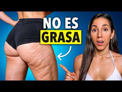 What ACTUALLY WORKS to GET RID of CELLULITE