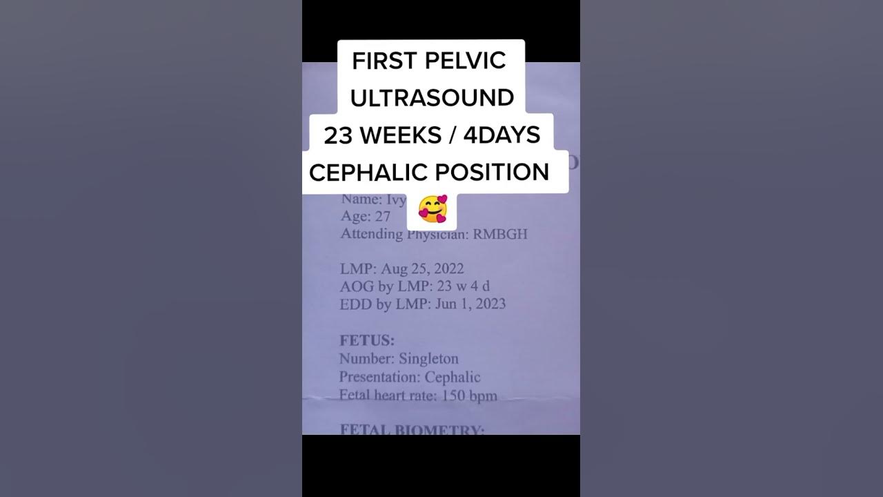 paano-maging-cephalic-position-si-baby-base-my-experience