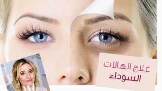 #أفضل طريقة #لإزالة _شعر الوجه بدون ألم وبدون ضهور الحبوب#كيفية تخلص من الهلات سوداء?