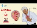 Angina and mi heart disease spectrum