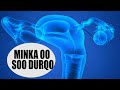 MINKA OO SOO DHACO AMA SOO DURQO UTERINE PROLAPSE Dr Fahad Al Al Attas 