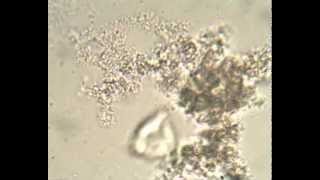 Bacterial Cells Agregate In Flocs