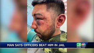 Man claims San Joaquin County jail guards severely beat him