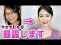 私がCAになるために今までした全ての施術をお値段と共に暴露します。【手術の詳しい内容と正直な意見！】