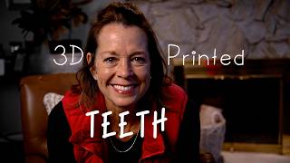 Jean Cant Believe Her New Smile The Four Ever Smile