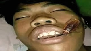 Top 5 Cockroach
