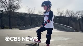 Baking Up Joy And Beating The Odds The Uplift