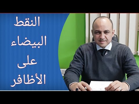 اسباب النقط البيضاء على الاظافر و طريقة علاجها - دكتور حاتم فاروق