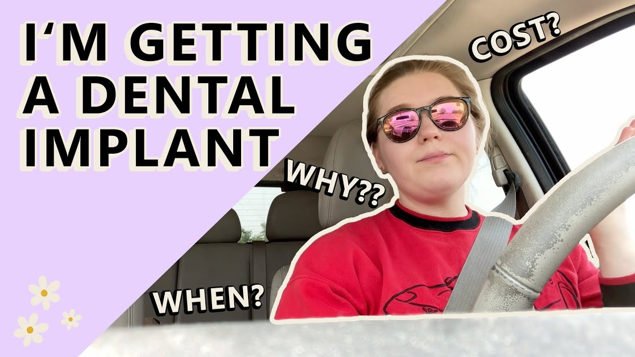 Dental Implant, chat with me about TMJ & Invisalign Thrift with me