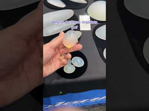 Where Do These
