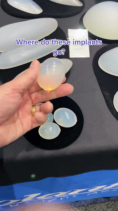 Where Do These Implants Go?