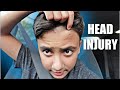 KIDS INJURY AT SCHOOL | UNEXPECTED HEAD INJURY AT SCHOOL with ANOTHER KID STUDENT *SCHOOL ACCIDENT*