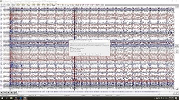 fMRI EEG Pulse Artifact Correction In BESA Research