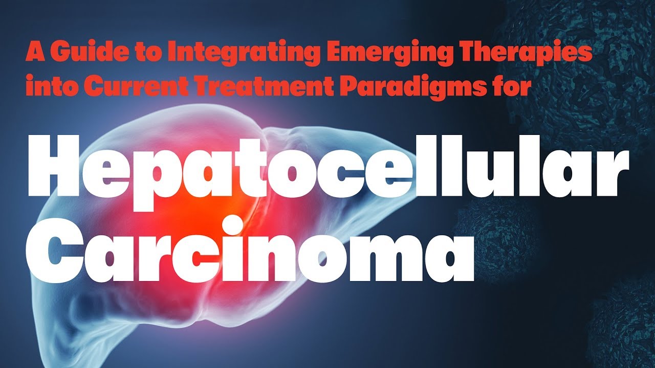 Hepatocellular Carcinoma A Guide To Integrating Emerging Therapies