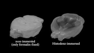 Celebrity Contrast-enhanced CT imaging of mouse brain Net Worth