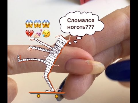 Кожа сухая в пупырышках и чешется Кожа сухая в пупырышках и чешется