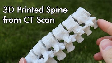 3D Printed Spine from a CT Scan