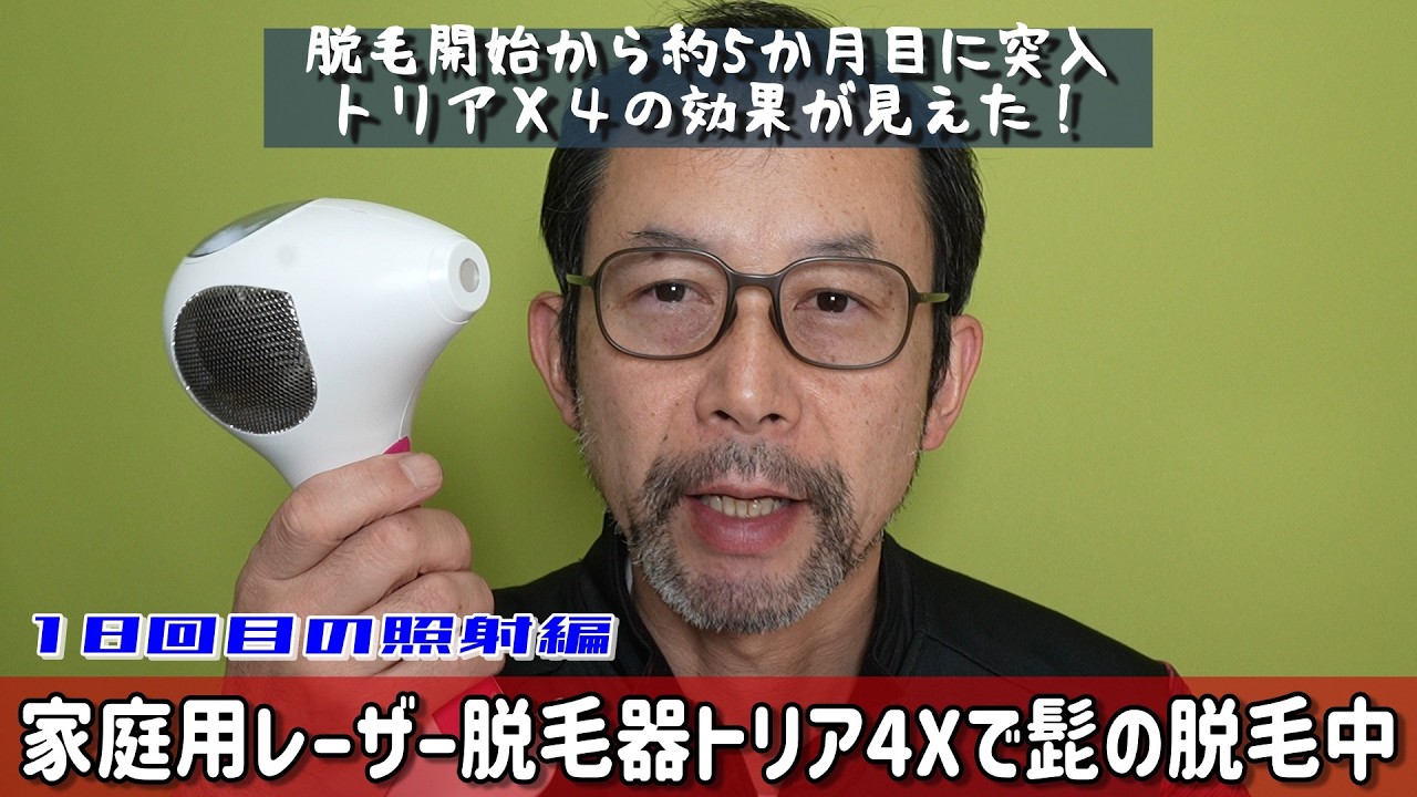 5 Months Since Starting Beard Removal with Tria X4: Checking