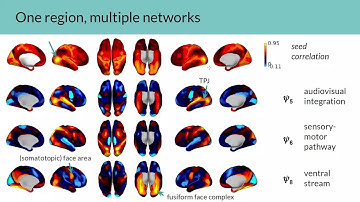 OHBM 2022 | 2609 | Symposium | Hamid Behjat | Novel insights into brain organization via graph sig…