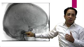 eQ Recent Exam Questions Radiology - Myelography by Dr. Sumer Sethi