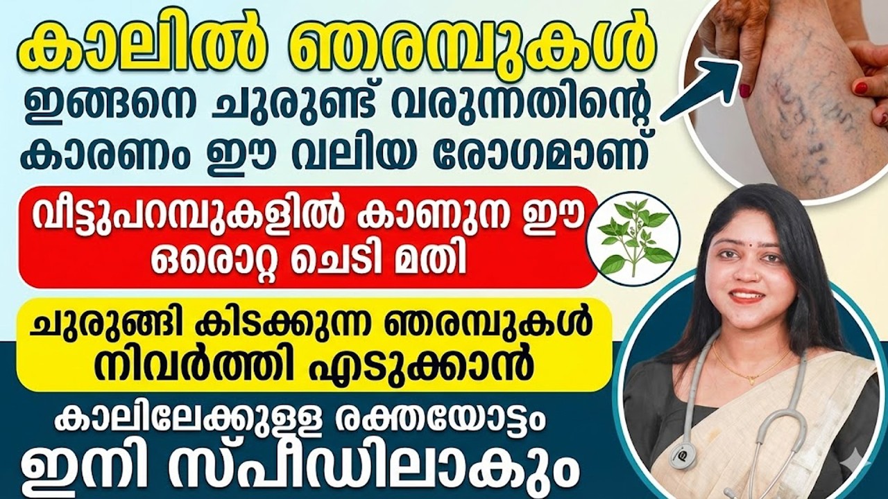 കാലിൽ ഇങ്ങനെ ഞെരമ്പുകൾ ചുരുണ്ട് വരുന്നതിന്റെ കാരണം ഈ വലിയ രോഗമാണ് | vericose vein maran