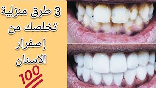 3 وصفات منزلية للتخلص من الأسنان الصفراء ?