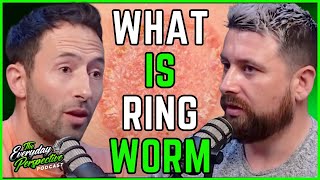 Famous Doctor Explains Ringworm (aka Tinea) Incl. Symptoms, Causes & Treatment | Everyday Perspective Clips Wealth