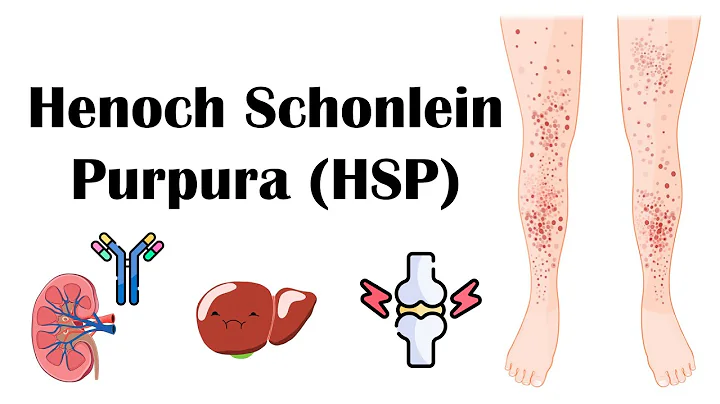 Henoch Schoenlein Purpura (HSP) - Causes, Pathophysiology, Diagnosis, And Treatment - DayDayNews