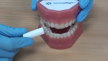 How to use Chewies with your orthodontic aligners.