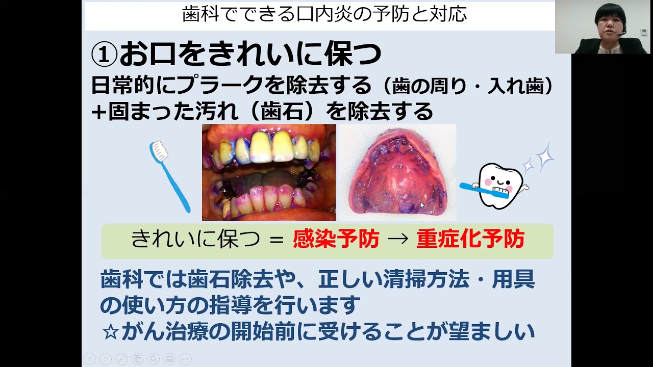 ご存じですか周術期等口腔機能管理②】がん治療と周術期口腔管理 主に