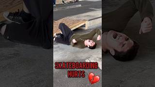 Skateboarding Hurts! #skateboarding