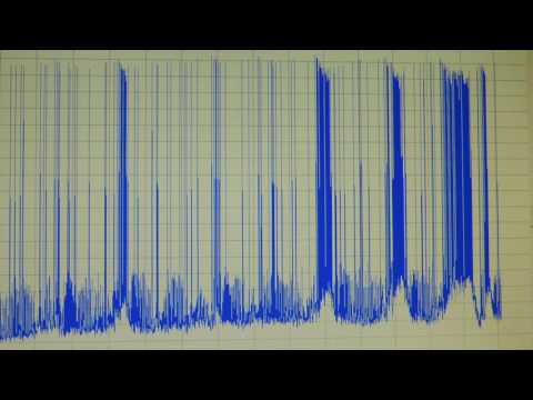 هورمون عصبی در گردش اکسی توسین (OT)