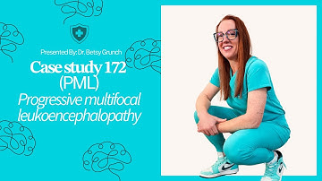 𝐂𝐚𝐬𝐞 𝐬𝐭𝐮𝐝𝐲 𝟏𝟕𝟐 - 𝘗𝘳𝘰𝘨𝘳𝘦𝘴𝘴𝘪𝘷𝘦 𝘮𝘶𝘭𝘵𝘪𝘧𝘰𝘤𝘢𝘭 𝘭𝘦𝘶𝘬𝘰𝘦𝘯𝘤𝘦𝘱𝘩𝘢𝘭𝘰𝘱𝘢𝘵𝘩𝘺⁣