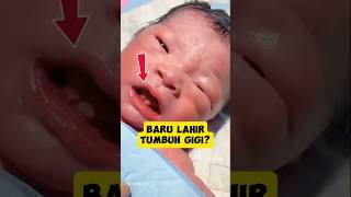 Download Lagu Mengapa Bayi Yang Baru Lahir Tapi Sudah Mempunyai Gigi ‼️😱? MP3