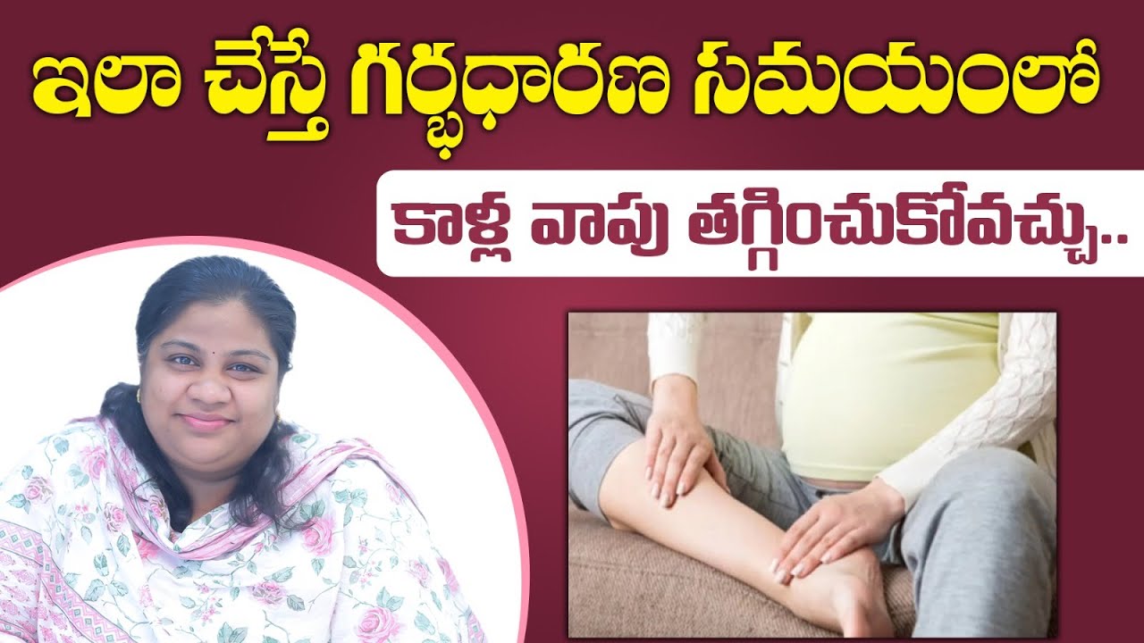 How to Reduce Swelling in Legs During Pregnancy||Swollen feet||IVY ...