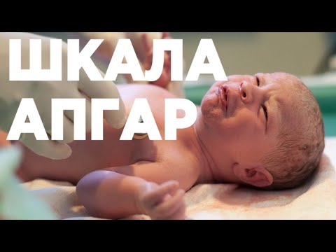 Video: Što Znači Apgar Skala?