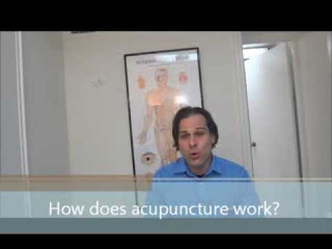 4 things you should know about Acupuncture