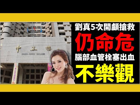 #搶救28天/劉真5次開顱搶救仍命危 血管栓塞出血不樂觀