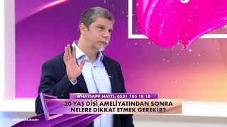20 Yaş dişi çekildikten sonra nelere dikkat etmeli?