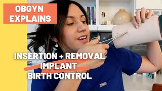 Insertion + Removal of Implant Birth Control