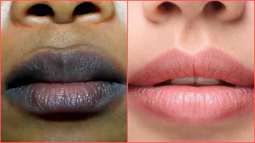 ¿Pueden el limón y el azúcar limpiar los labios?