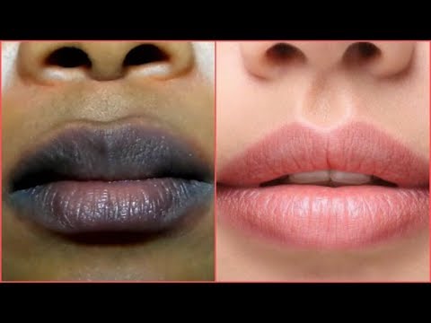 Vídeo: Cómo Aclarar Los Labios Oscuros: 16 Remedios Caseros Naturales