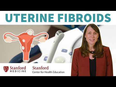 Uterine Fibroids: What are they? What are the symptoms & treatments?