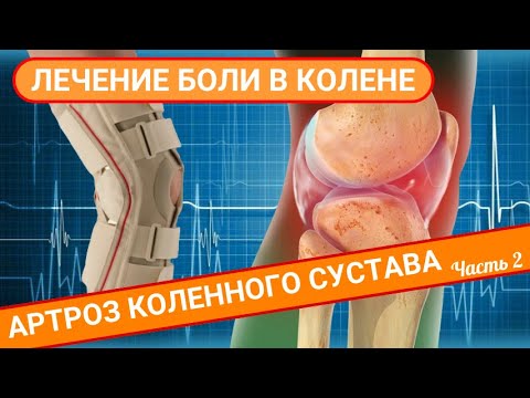 ЛЕЧЕНИЕ БОЛИ В КОЛЕНЕ. Артроз коленного сустава (Часть 2)